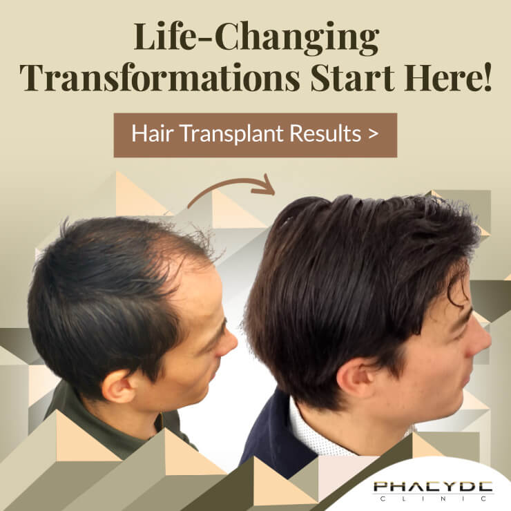 no.1 Hair Transplantation