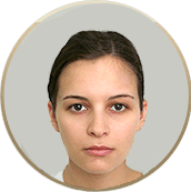 hair-transplant-woman